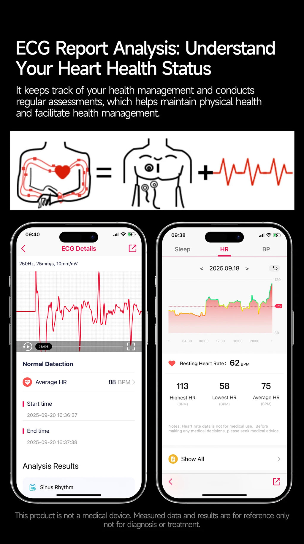 Reloj Inteligente 2026 con Diagnóstico Preciso de ECG, Medición de Grasa Corporal, Oxígeno en Sangre, Presión Arterial, Pantalla HD AMOLED, Llamadas, para Hombres y Mujeres