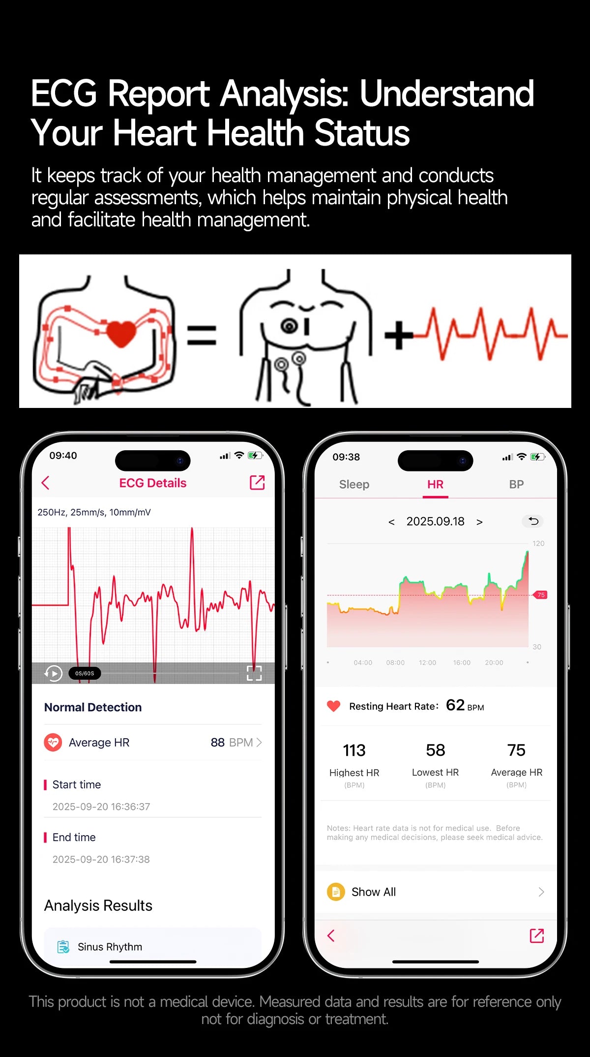 Reloj Inteligente 2026 con Diagnóstico Preciso de ECG, Medición de Grasa Corporal, Oxígeno en Sangre, Presión Arterial, Pantalla HD AMOLED, Llamadas, para Hombres y Mujeres